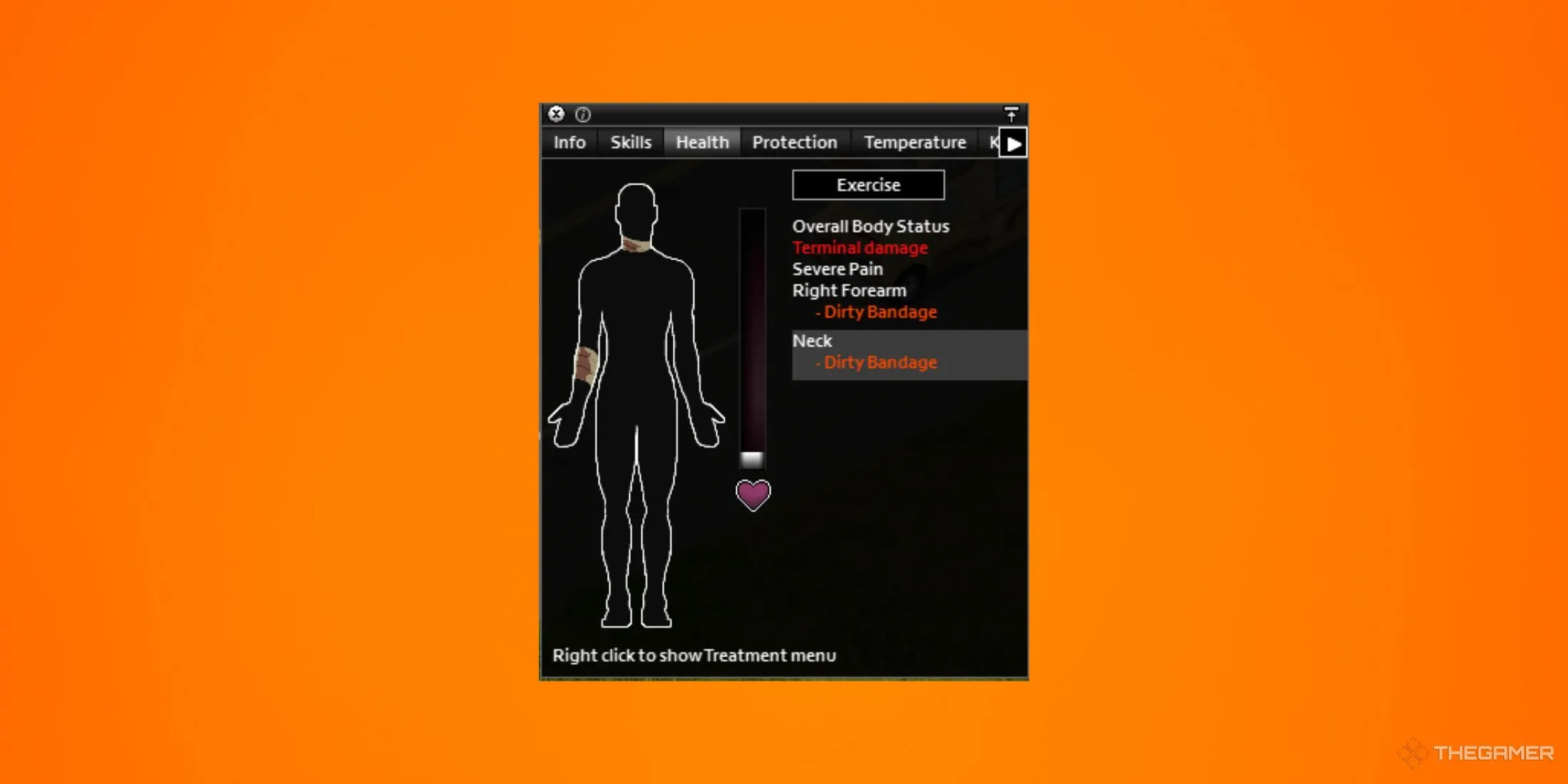 Màn hình thông báo vết thương và tình trạng sức khỏe trong game sinh tồn Project Zomboid.